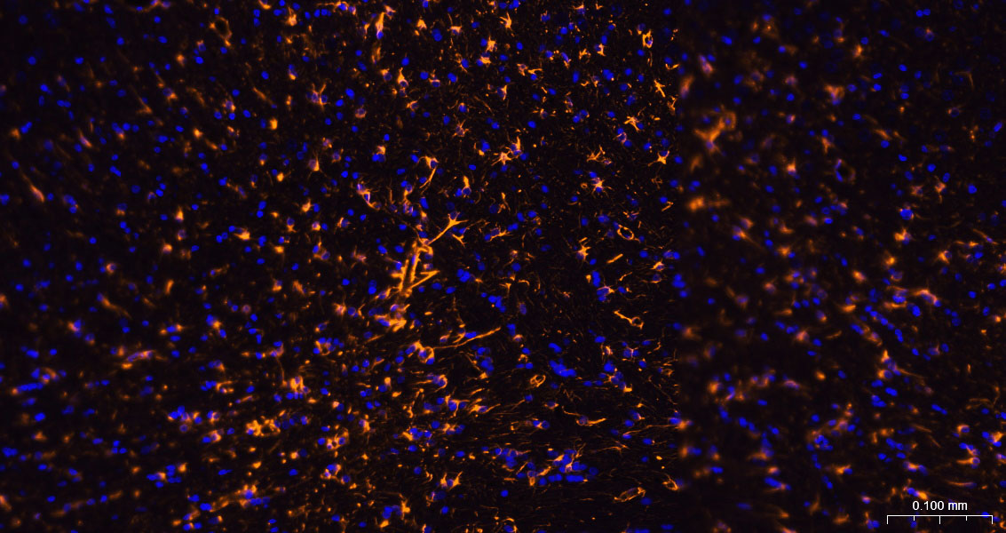 BF555标记的羊抗兔IgG H&L