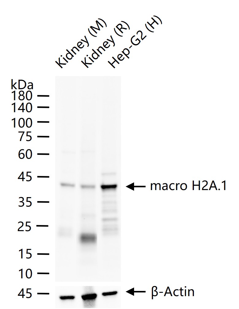 macro H2A.1 Recombinant Rabbit mAb (一抗) - WB,IHC-P,IHC-F,IF,ICC/IF | Bioss