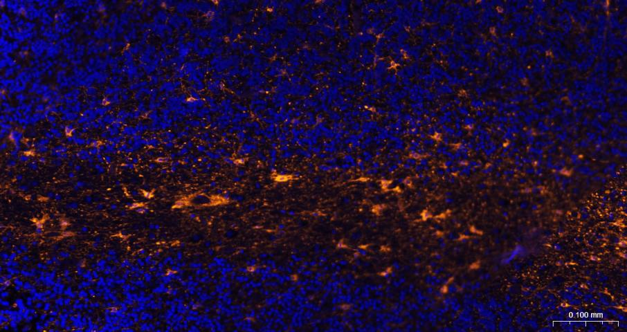 BF555标记的羊抗兔IgG H&L