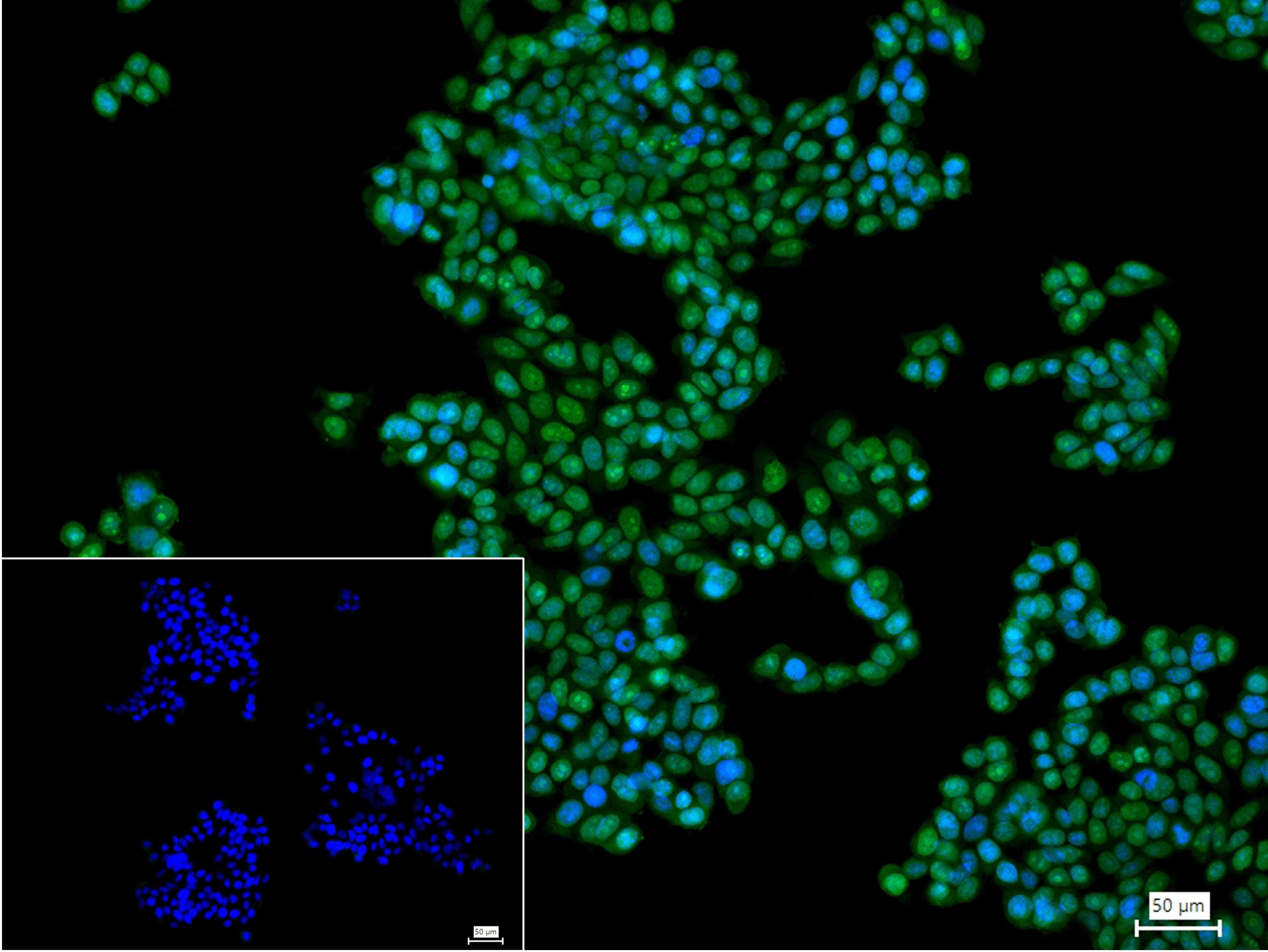 拓普西异构酶Ⅰ重组兔单抗