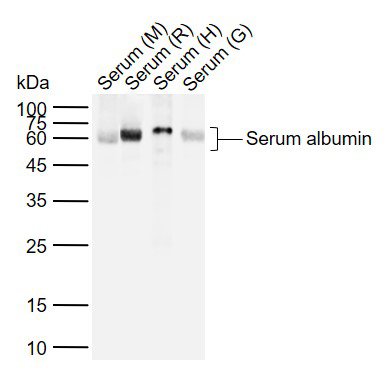 Human Serum albumin Rabbit pAb, Loading Control (一抗) | Bioss