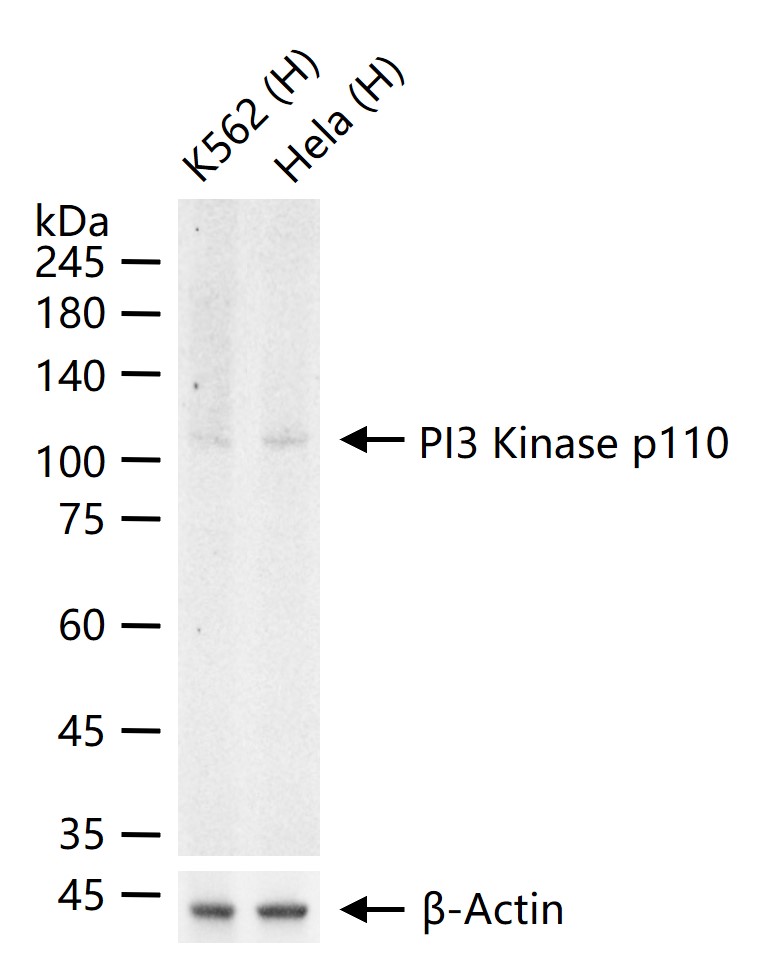 PI3 Kinase p110 beta Rabbit pAb (一抗) - WB,IHC-P,IHC-F,IF,ICC/IF | Bioss