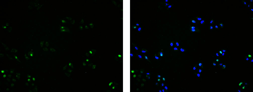 BrdU(Proliferation Marker) Mouse mAb (一抗) - ICC/IF | Bioss