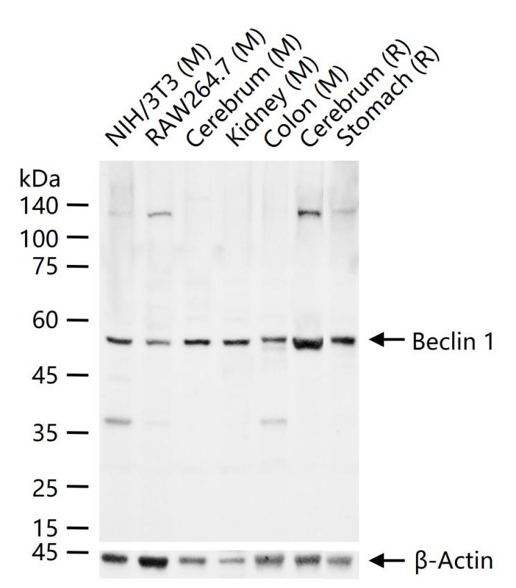 Beclin 1 Rabbit pAb (一抗) - WB,IHC-P,IHC-F,IF | Bioss