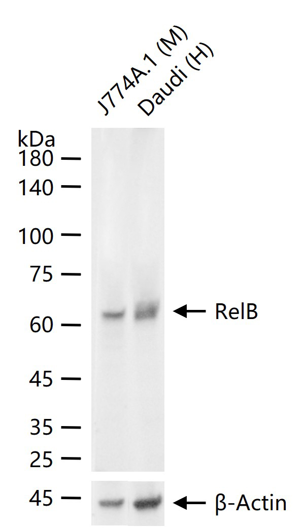 转录因子RelB蛋白重组兔单抗