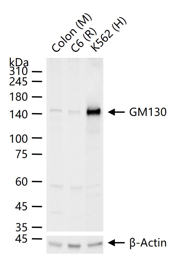 高尔基体自身蛋白GM130重组兔单抗