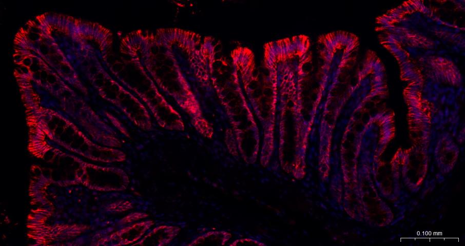 Na+/K+-ATPase α1 钠钾ATP酶α1抗体-bs-9570R