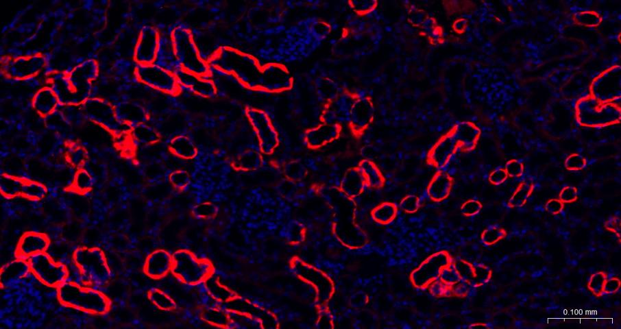 Na+/K+-ATPase α1 钠钾ATP酶α1抗体-bs-9570R