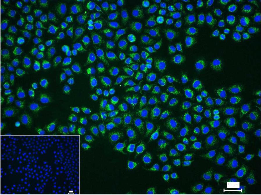 TSPO蛋白重组兔单抗