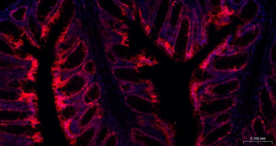 Na+/K+-ATPase α1 钠钾ATP酶α1抗体-bs-9570R