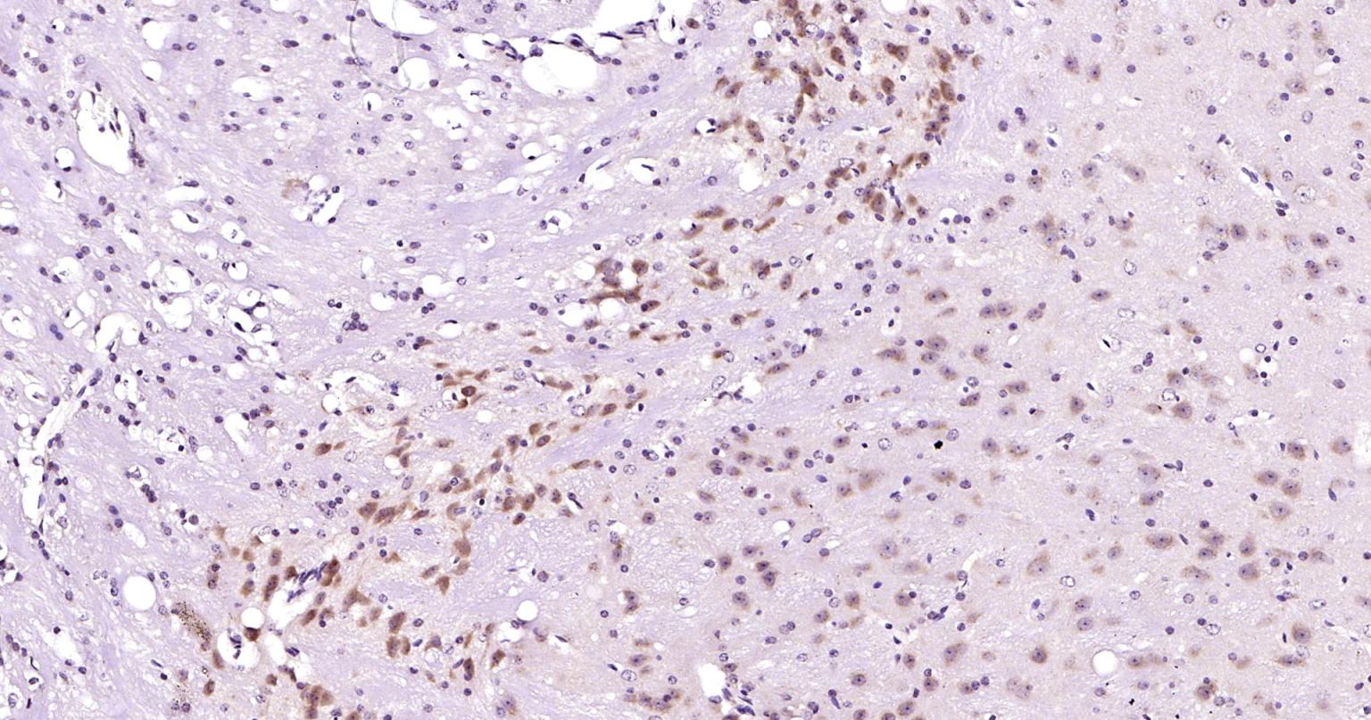 自噬效应蛋白Beclin 1抗体-bs-55024R