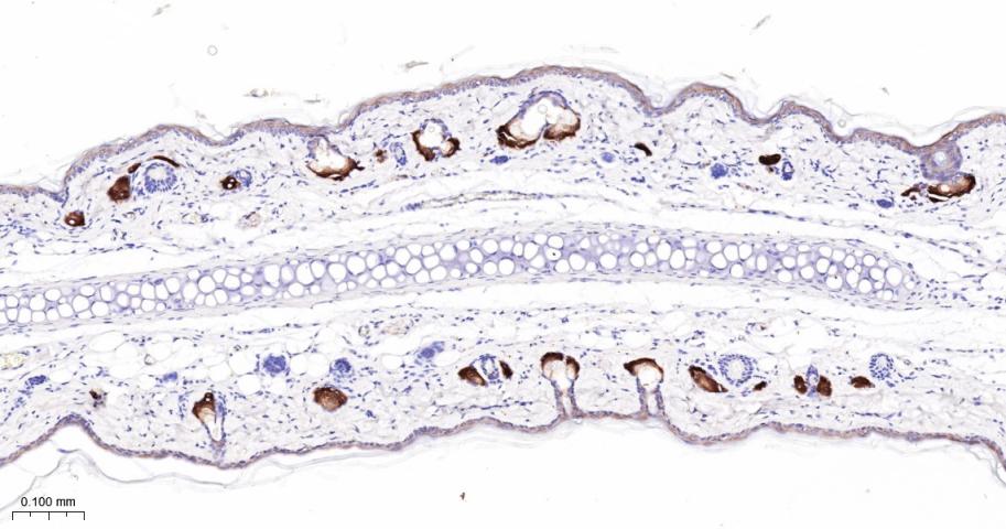 法尼基二磷酸法尼基转移酶1/鲨烯合成酶重组兔单抗-bsm-61816R