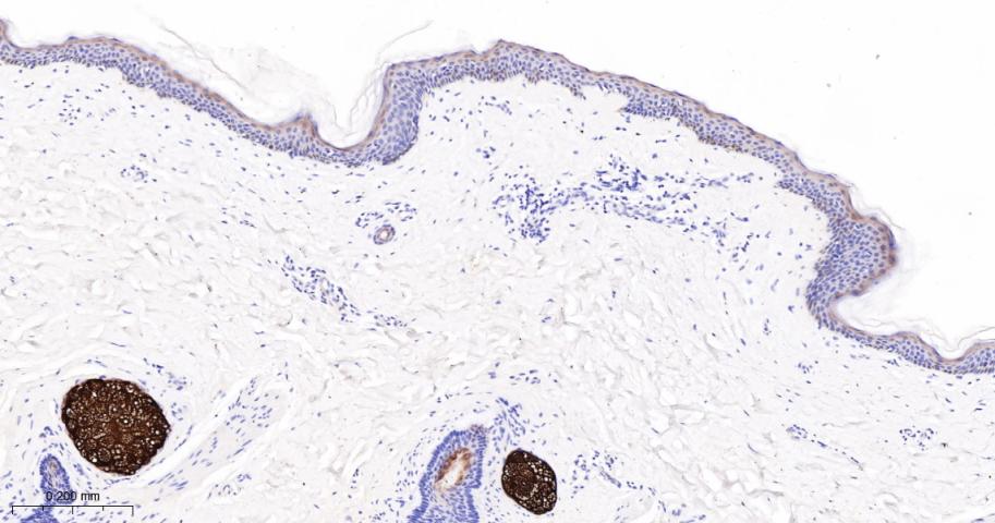 法尼基二磷酸法尼基转移酶1/鲨烯合成酶重组兔单抗-bsm-61816R