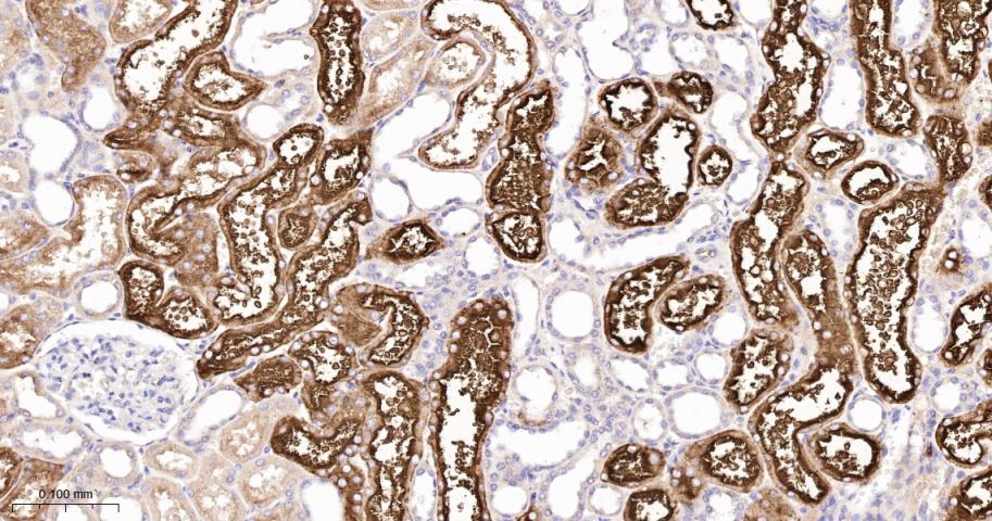 γ谷氨酰转移酶重组兔单抗