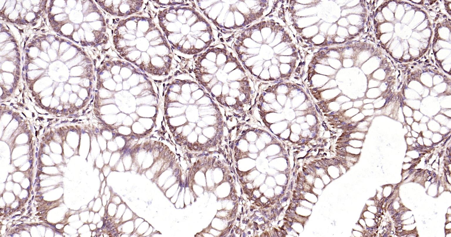 自噬效应蛋白Beclin 1抗体-bs-55024R