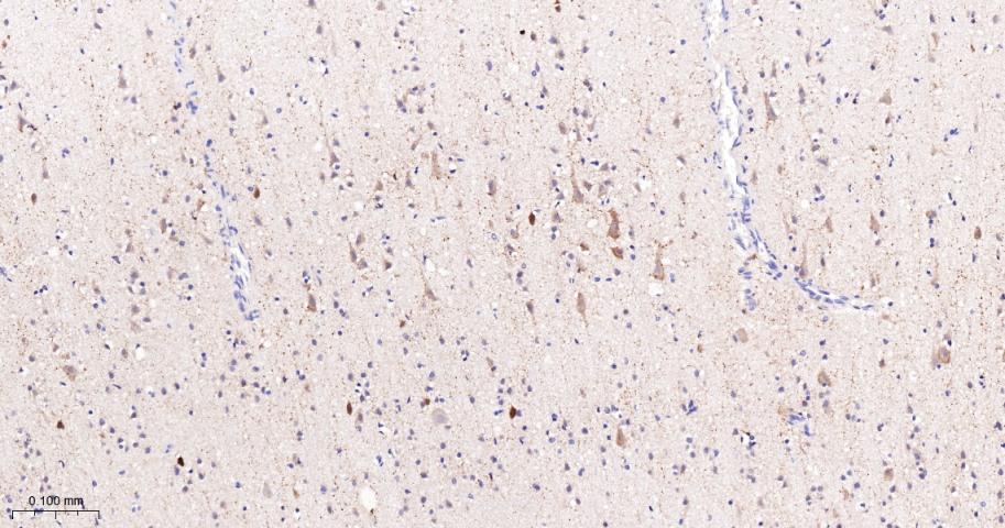 法尼基二磷酸法尼基转移酶1/鲨烯合成酶重组兔单抗-bsm-61816R