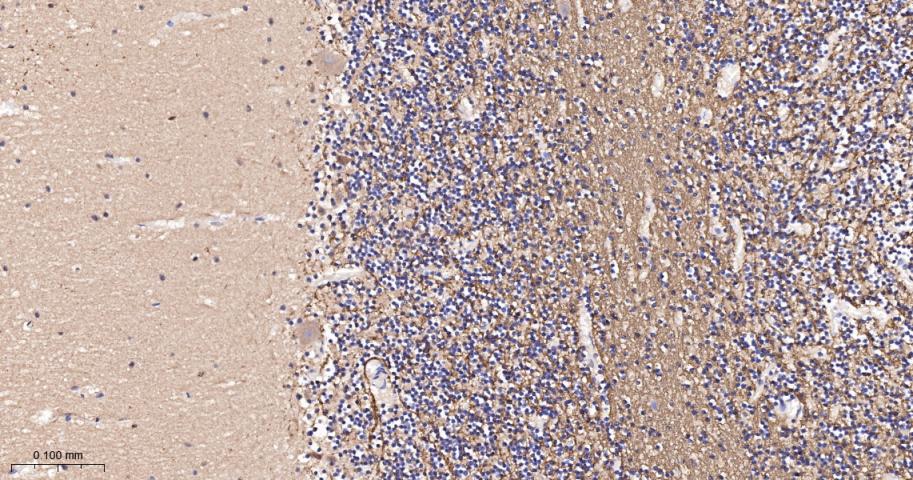 沉默调节相关蛋白2重组兔单抗