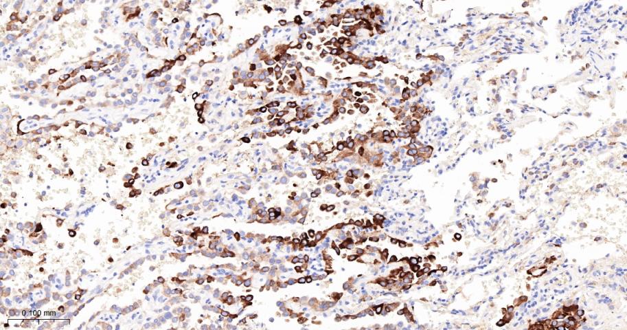 法尼基二磷酸法尼基转移酶1/鲨烯合成酶重组兔单抗-bsm-61816R