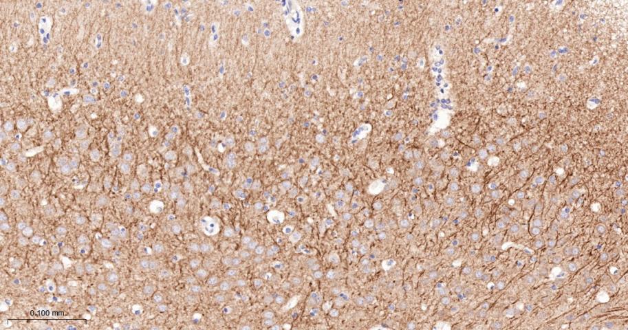 促代谢型谷氨酸受体5重组兔单抗