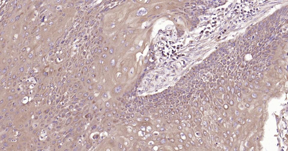 自噬效应蛋白Beclin 1抗体-bs-55024R