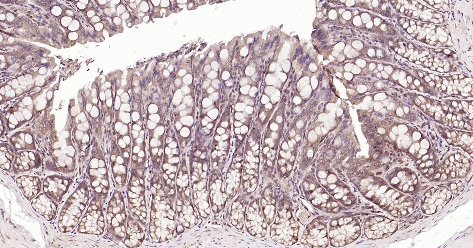 自噬效应蛋白Beclin 1抗体-bs-55024R