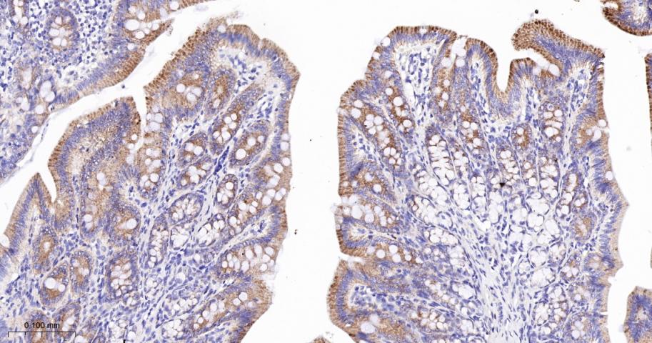 高尔基体自身蛋白GM130重组兔单抗