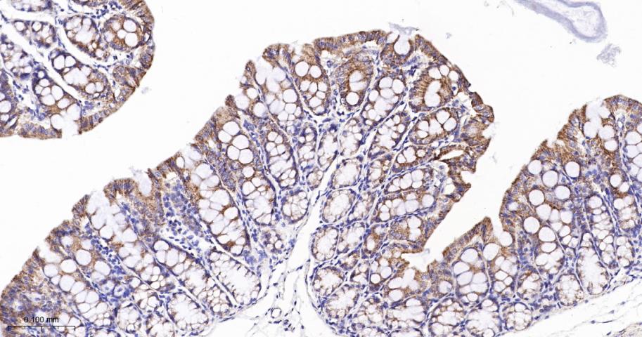 高尔基体自身蛋白GM130重组兔单抗