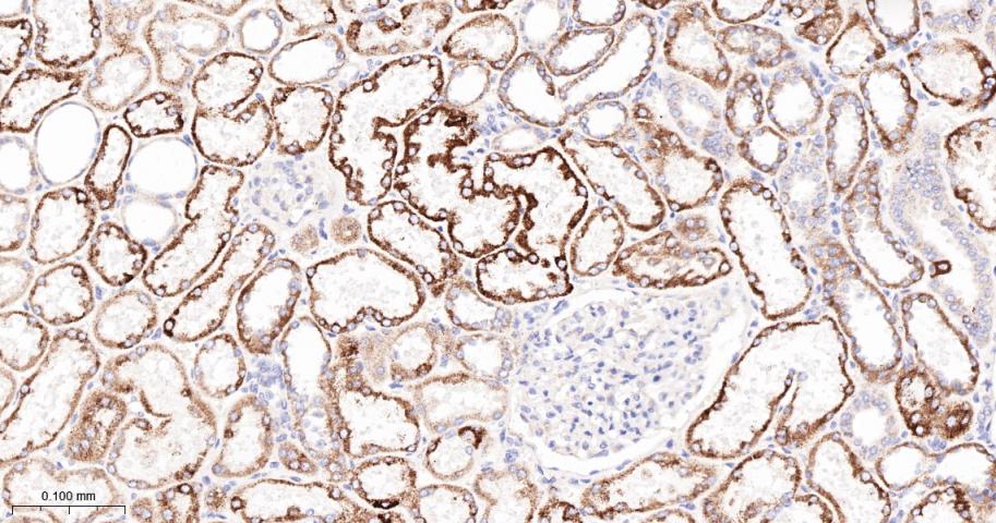 高尔基体自身蛋白GM130重组兔单抗