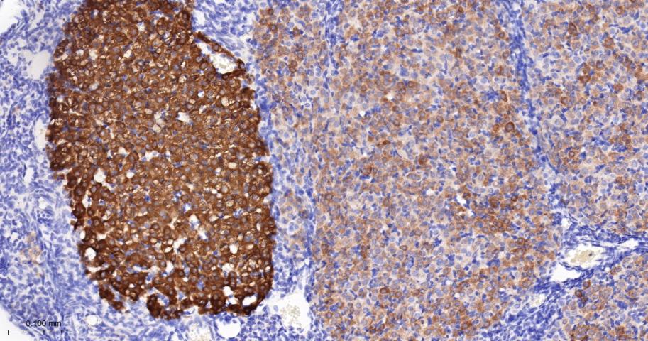 法尼基二磷酸法尼基转移酶1/鲨烯合成酶重组兔单抗-bsm-61816R