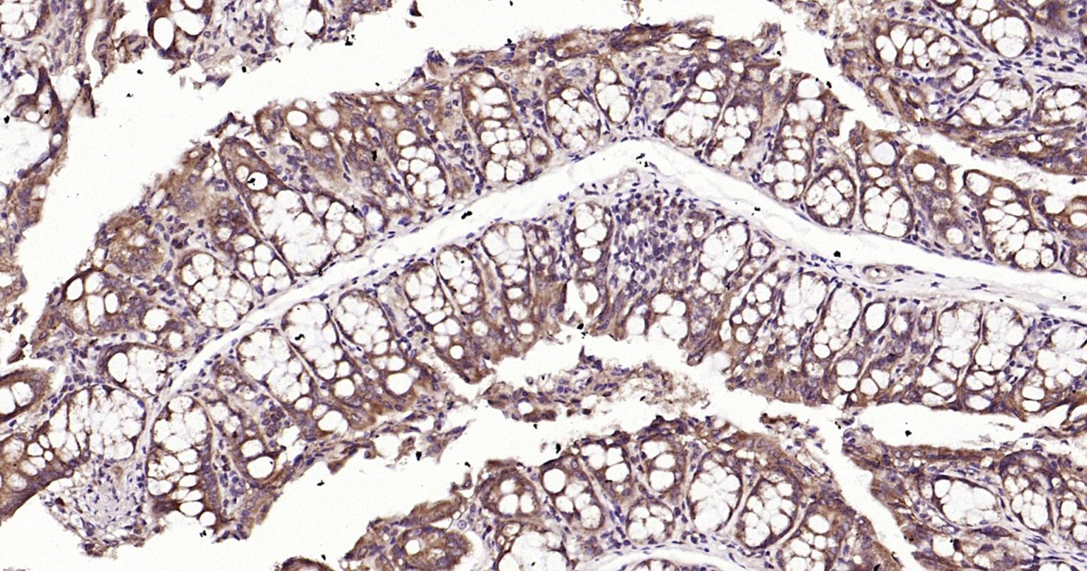 自噬效应蛋白Beclin 1抗体-bs-55024R