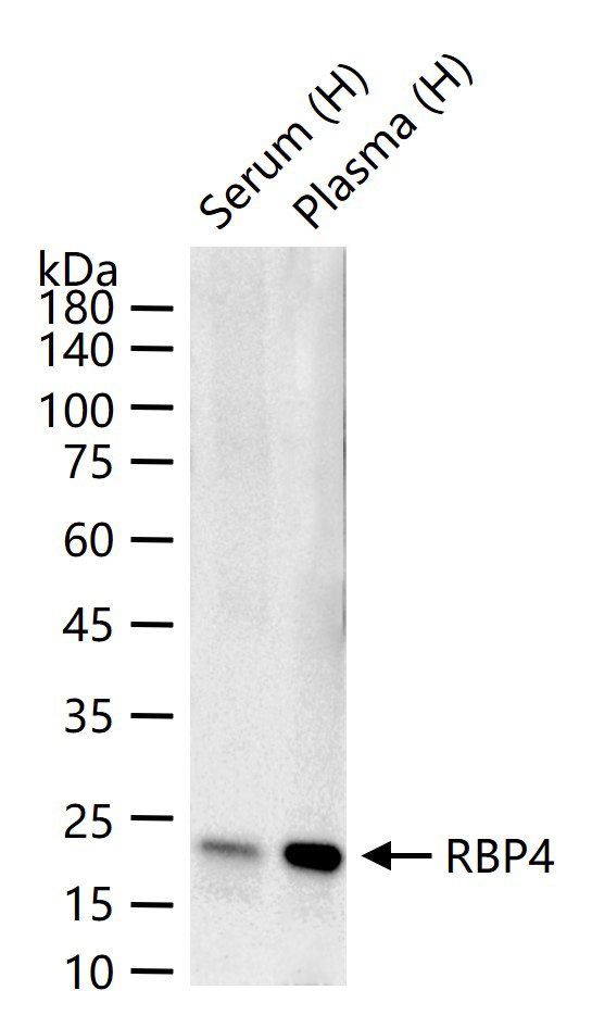 RBP4 Recombinant Rabbit mAb (一抗) - WB,IHC-P,IHC-F,IF,Flow-Cyt,ICC/IF | Bioss