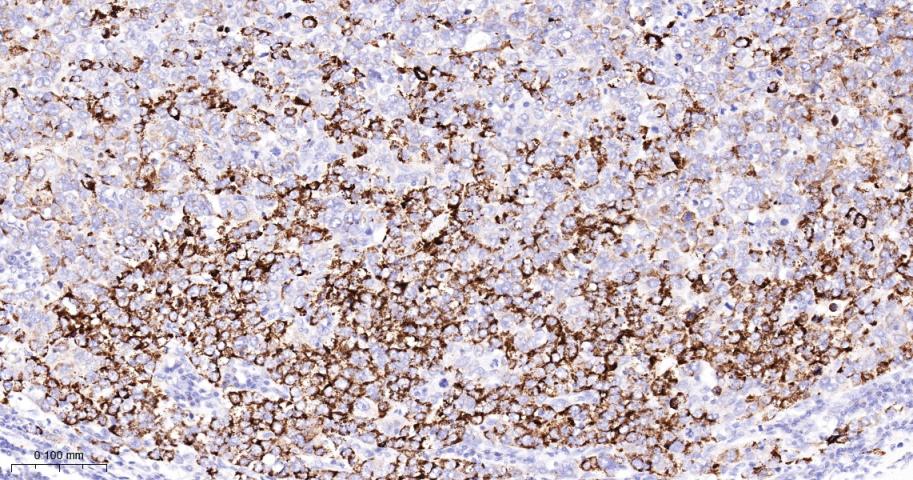 高尔基体自身蛋白GM130重组兔单抗