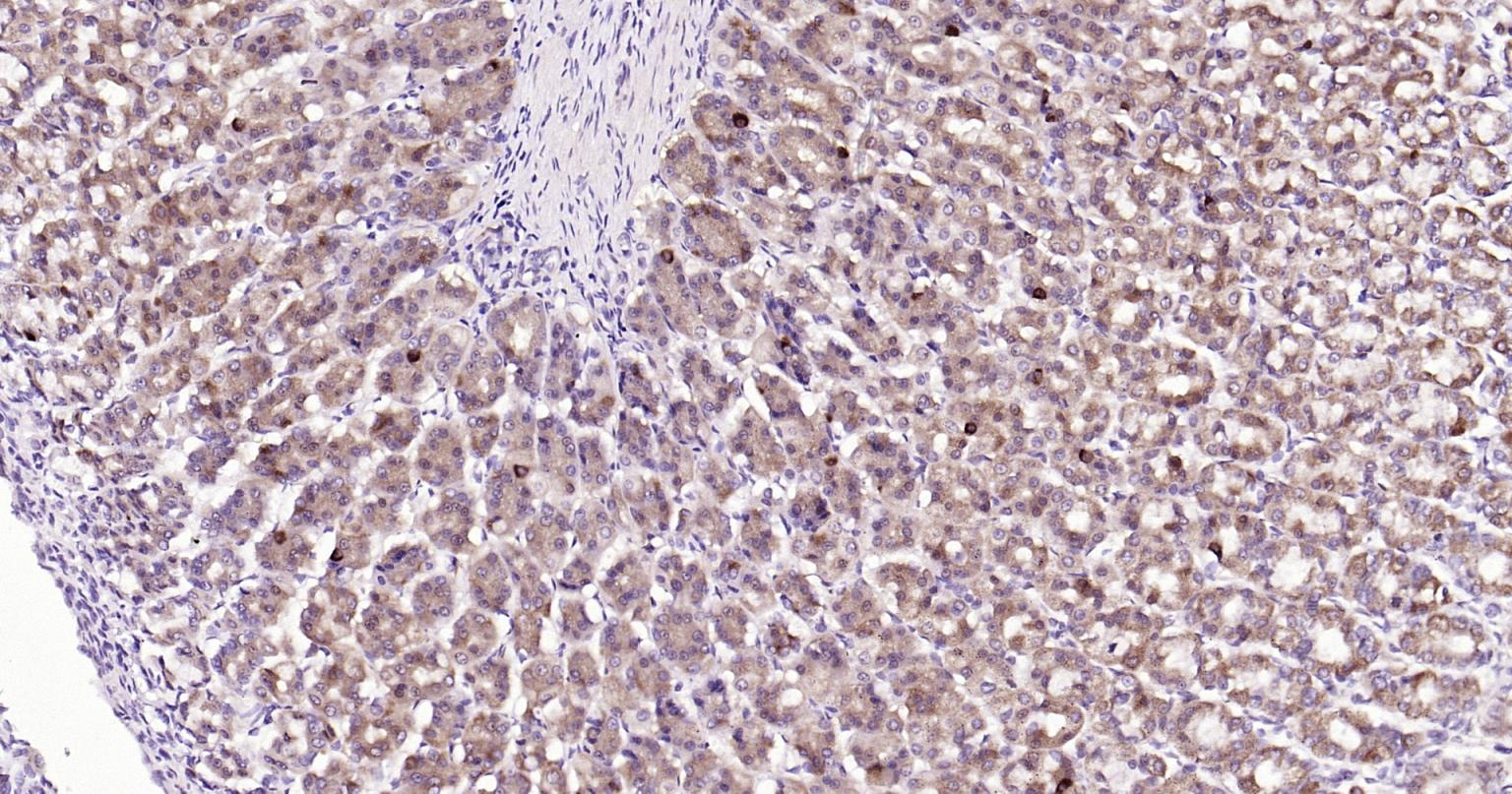 自噬效应蛋白Beclin 1抗体-bs-55024R