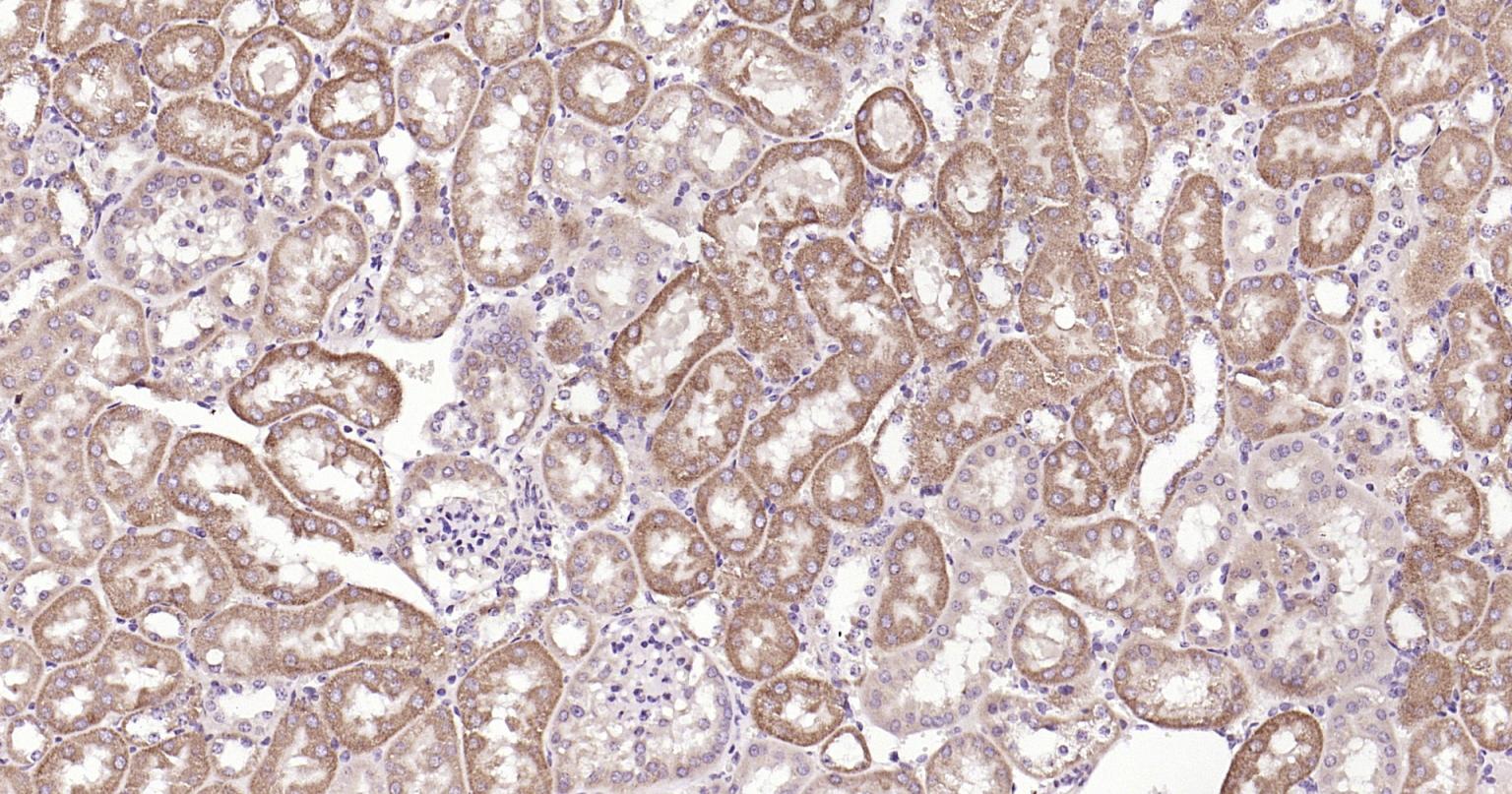 自噬效应蛋白Beclin 1抗体-bs-55024R