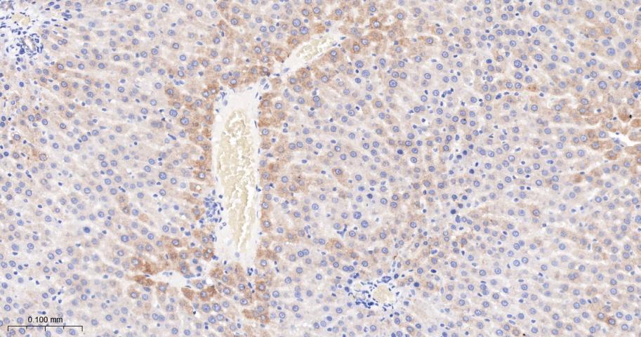 法尼基二磷酸法尼基转移酶1/鲨烯合成酶重组兔单抗-bsm-61816R