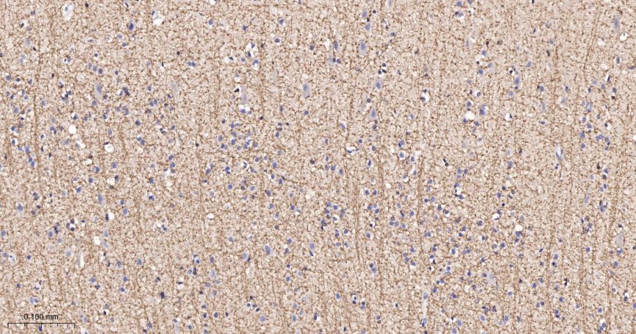 沉默调节相关蛋白2重组兔单抗