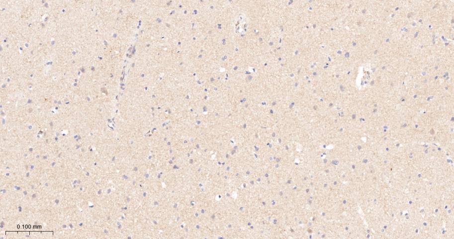 促代谢型谷氨酸受体5重组兔单抗