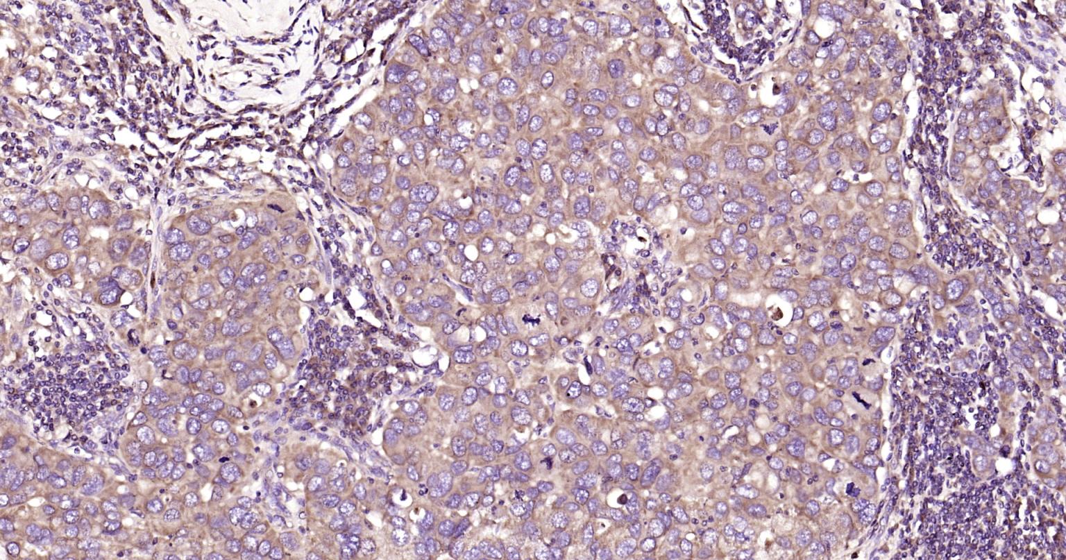 自噬效应蛋白Beclin 1抗体-bs-55024R