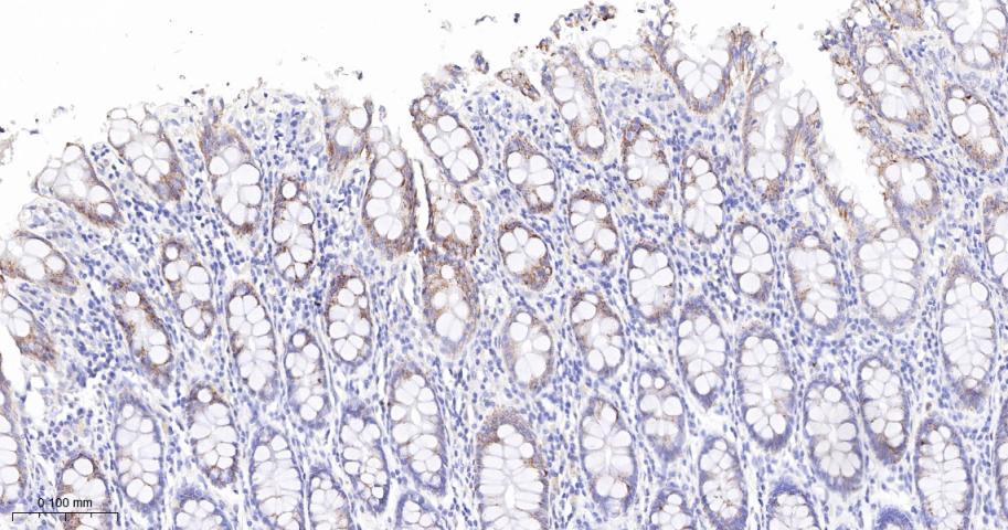 高尔基体自身蛋白GM130重组兔单抗
