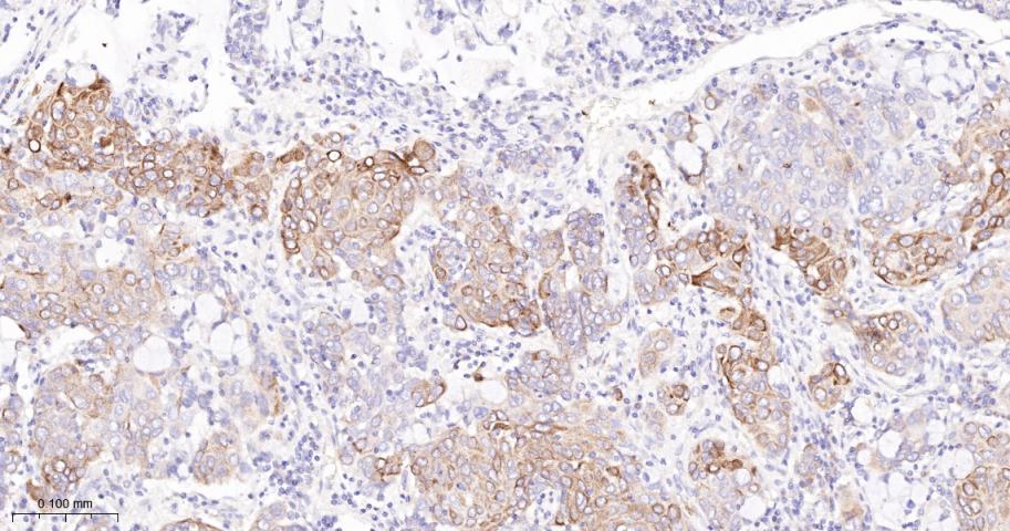 高尔基体自身蛋白GM130重组兔单抗