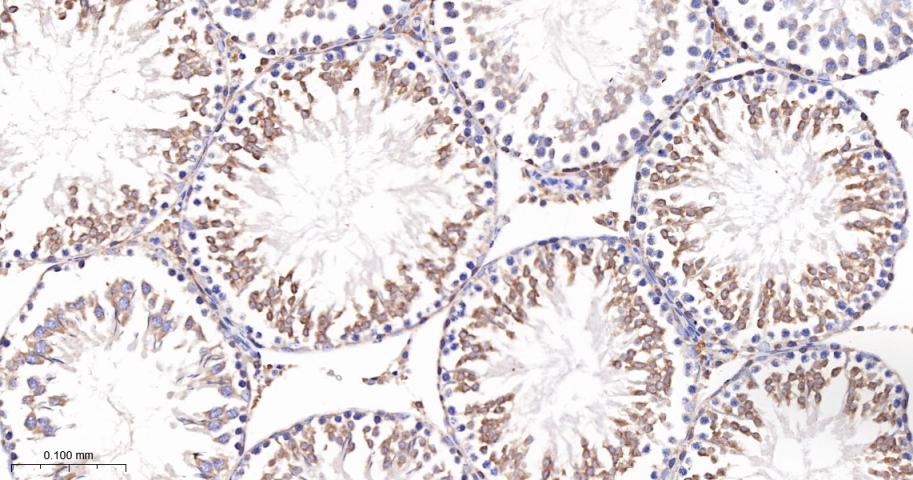 法尼基二磷酸法尼基转移酶1/鲨烯合成酶重组兔单抗-bsm-61816R