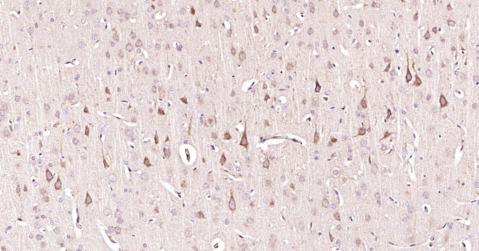 自噬效应蛋白Beclin 1抗体-bs-55024R