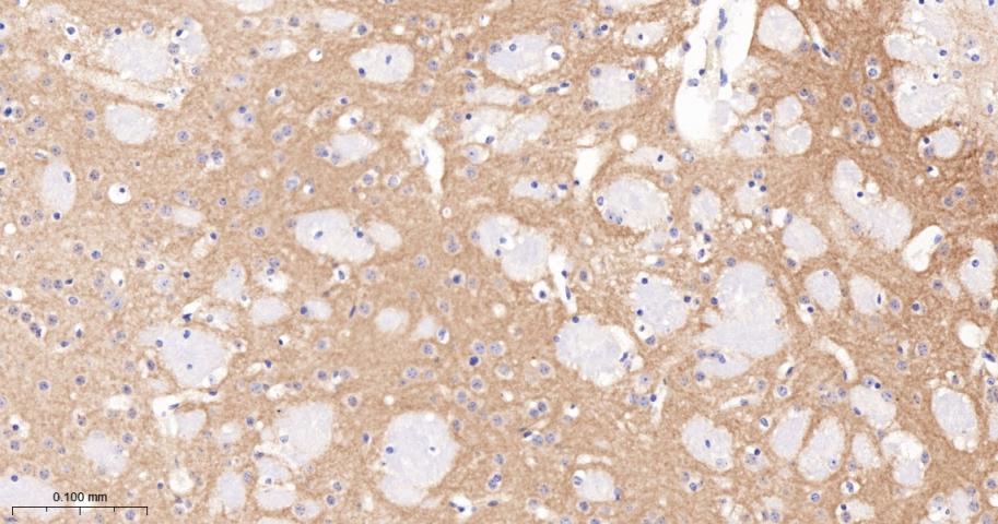 促代谢型谷氨酸受体5重组兔单抗