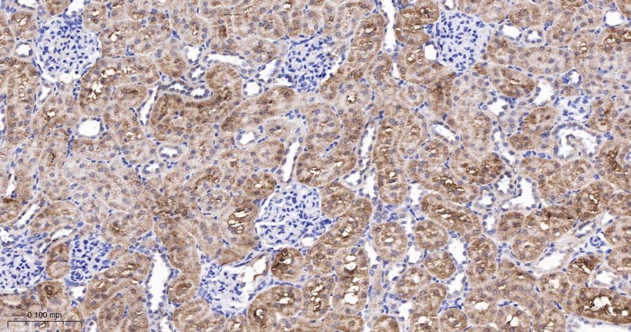 高尔基体自身蛋白GM130重组兔单抗