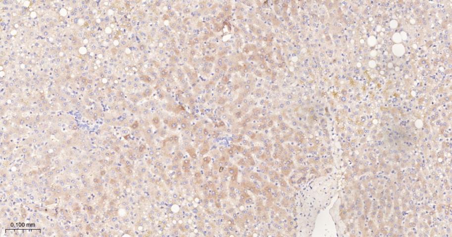 法尼基二磷酸法尼基转移酶1/鲨烯合成酶重组兔单抗-bsm-61816R