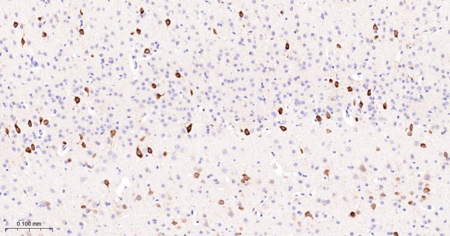 法尼基二磷酸法尼基转移酶1/鲨烯合成酶重组兔单抗-bsm-61816R