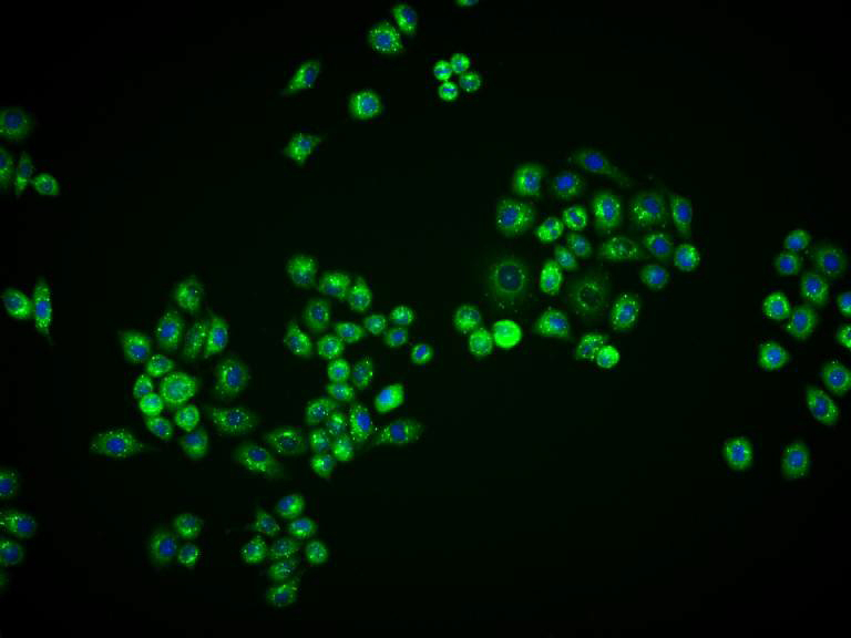 泛素结合蛋白P62重组兔单抗