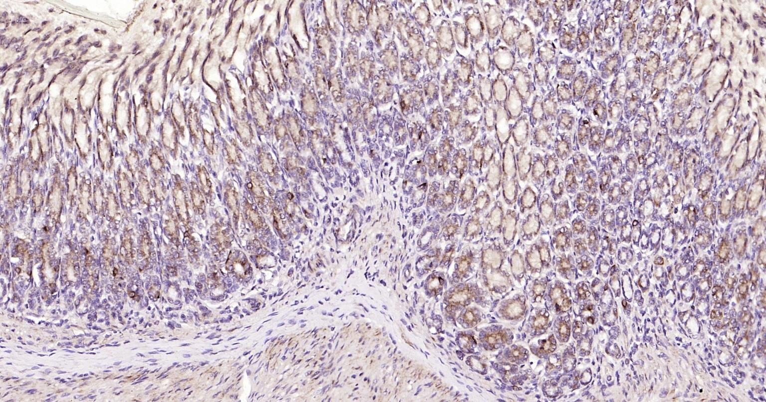 自噬效应蛋白Beclin 1抗体-bs-55024R