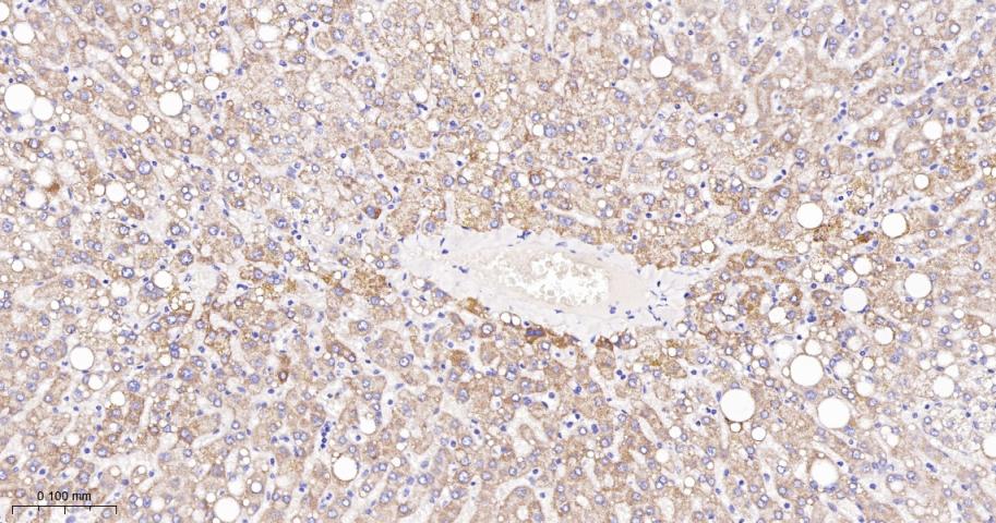 高尔基体自身蛋白GM130重组兔单抗