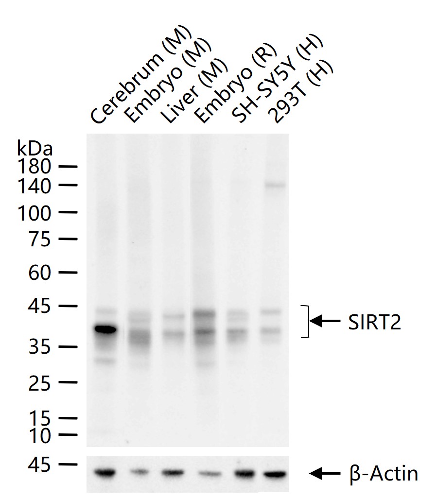 沉默调节相关蛋白2重组兔单抗